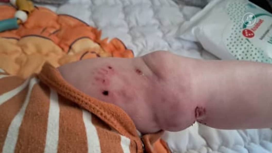 Hart van Nederland - Late Editie: Gezin aangevallen door herdershonden in Coevorden, baby in beentje gebeten